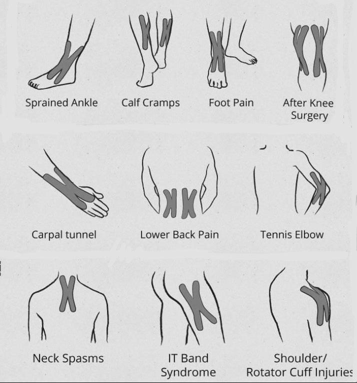 Deez Athletic Sports Tape