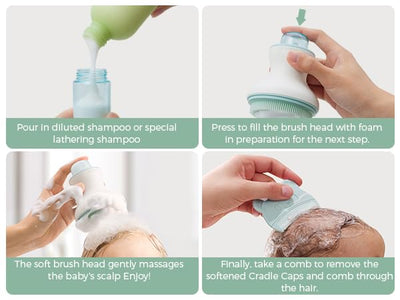 Momcozy Innovative Baby Cradle Cap Brush