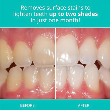 Opalescence Whitening Toothpaste