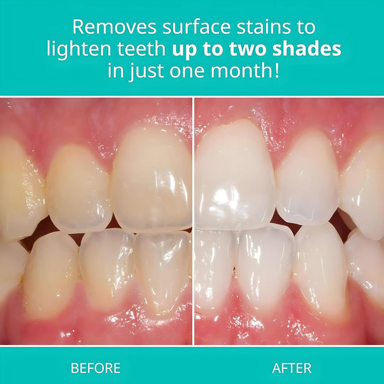 Opalescence Whitening Toothpaste