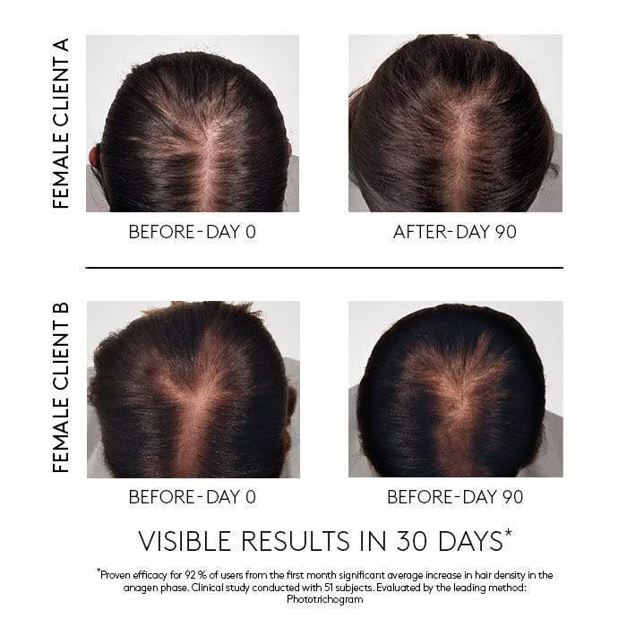 Rene Furterer Triphasic Reactionnel (12X5Ml)